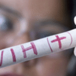 Alta incidencia de VIH entre personas de 20 a 39 años: superan el 60% de los casos