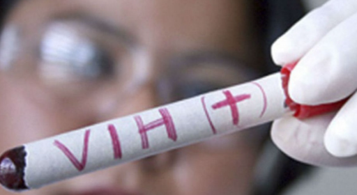 Alta incidencia de VIH entre personas de 20 a 39 años: superan el 60% de los casos